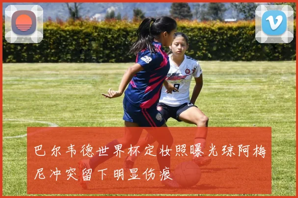 巴尔韦德世界杯定妆照曝光琼阿梅尼冲突留下明显伤痕